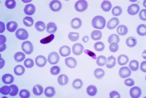 getting malaria in mali